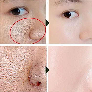Magical Pore Eraser - LightsBetter